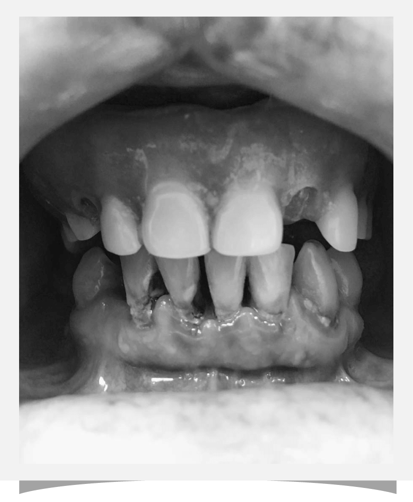 Cambrian Dental Before Image