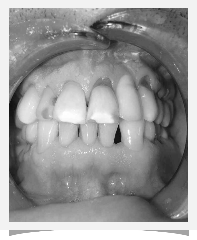Cambrian Dental Before Image