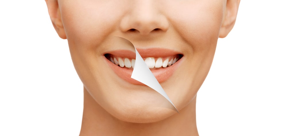 Teeth whitening myths busted